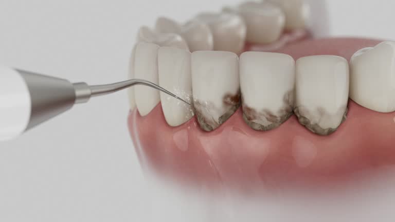 Reliable Wisdom Tooth Removal contractor in Lincoln County County, GA by Dentist Open Now